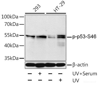 Immunohistochemistry analysis of paraffin-embedded mouse jejunum(intraperitoneal injection BrdU every 2 hours for 4 times) using Brdu Monoclonal Antibody at dilution of 1:300.