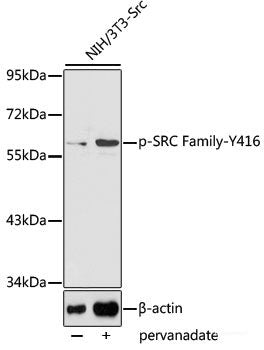 Western Blot analysis of various samples using CD34 Polyclonal Antibody at dilution of 1:800.