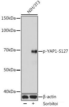 Western Blot analysis of various samples using IFNG Polyclonal Antibody at dilution of 1:400.