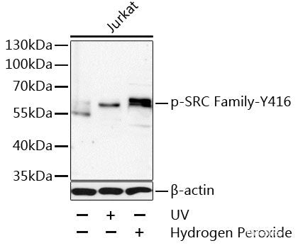 Immunohistochemistry analysis of paraffin-embedded rat cortex using TAC1 Polyclonal Antibody at dilution of 1:300.