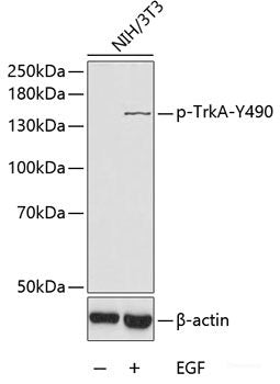 Western Blot analysis of various samples using CK-19 Polyclonal Antibody at dilution of 1:1000.
