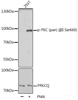 Immunohistochemistry analysis of paraffin-embedded human lung cancer using NFKBIB Polyclonal Antibody at dilution of 1:300.