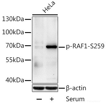 Western Blot analysis of various samples using ACTN1 Polyclonal Antibody at dilution of 1:2000.