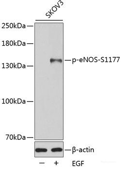 Western Blot analysis of various samples using GAP43 Polyclonal Antibody at dilution of 1:2000.