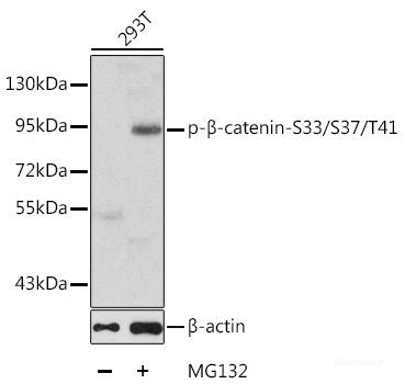 Western Blot analysis of various samples using VCAM1 Polyclonal Antibody at dilution of 1:600.