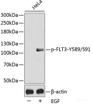 Immunohistochemistry analysis of paraffin-embedded human lymphoma using UCP2 Polyclonal Antibody at dilution of 1:300.