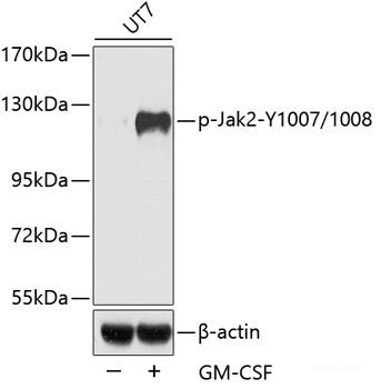 Immunohistochemistry analysis of paraffin-embedded mouse spinal marrow using NOS2 Polyclonal Antibody at dilution of 1:500.