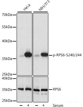 Immunohistochemistry analysis of paraffin-embedded mouse spinal marrow using NTRK2 Polyclonal Antibody at dilution of 1:400.
