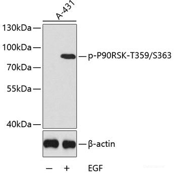 Western Blot analysis of various samples using LDHA Polyclonal Antibody at dilution of 1:1000.