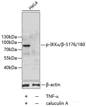 Immunohistochemistry analysis of paraffin-embedded mouse colon using PPARA Polyclonal Antibody at dilution of 1:300.