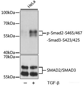 Immunohistochemistry analysis of paraffin-embedded mouse spleen using ATG7 Polyclonal Antibody at dilution of 1:300.