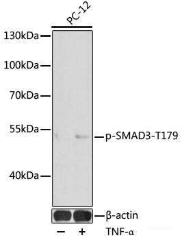 Immunohistochemistry analysis of paraffin-embedded Mouse brain using AQP4 Polyclonal Antibody at dilution of 1:400.