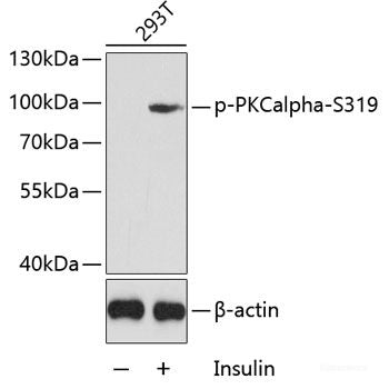Western Blot analysis of various samples using FOXO1 Polyclonal Antibody at dilution of 1:1000.