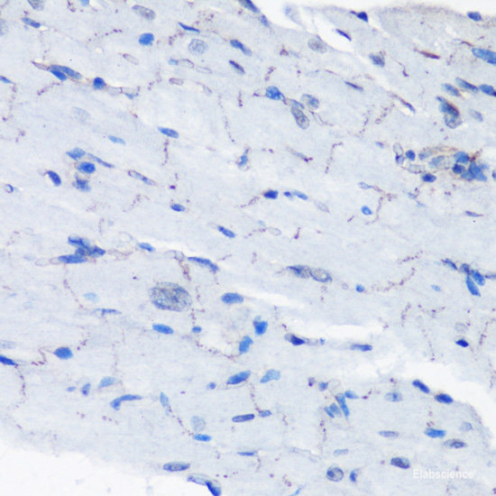 Western Blot analysis of various samples using GFAP Monoclonal Antibody at dilution of 1:1000.