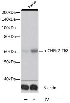 Western Blot analysis of various samples using PPARG Polyclonal Antibody at dilution of 1:1500.