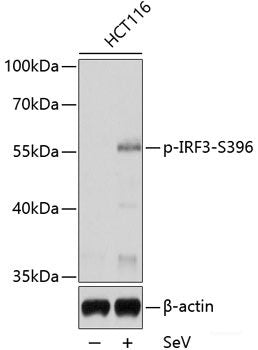 Western Blot analysis of various samples using N/H/K-Ras Polyclonal Antibody at dilution of 1:800.