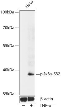 Western Blot analysis of various samples using P62/SQSTM1 Polyclonal Antibody at dilution of 1:1000.