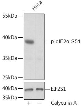 Immunohistochemistry analysis of paraffin-embedded mouse spleen using HMOX1 Polyclonal Antibody at dilution of 1:500.