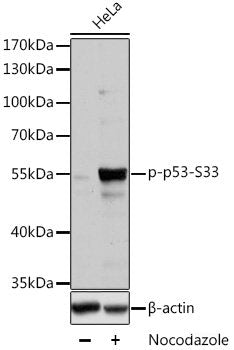 Immunohistochemistry analysis of paraffin-embedded human tonsil using SIRT1 Polyclonal Antibody at dilution of 1:500.