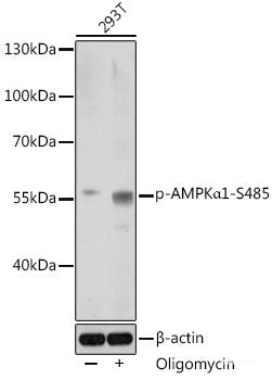 Immunohistochemistry analysis of paraffin-embedded human lung cancer using c-Fos Polyclonal Antibody at dilution of 1:200.