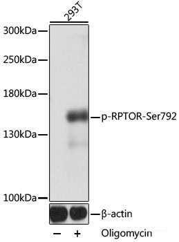 Immunohistochemistry analysis of paraffin-embedded Human tonsil using CD19 Polyclonal Antibody at dilution of 1:300.