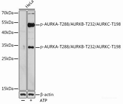 Western Blot analysis of various samples using NEFH Polyclonal Antibody at dilution of 1:1000.