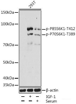 Western Blot analysis of various samples using Desmin Monoclonal Antibody at dilution of 1:1000.