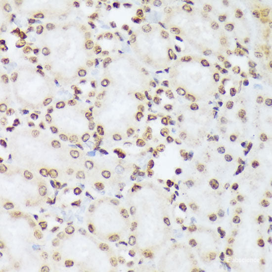 Immunohistochemistry analysis of paraffin-embedded mouse brain using S100B Polyclonal Antibody at dilution of 1:400.