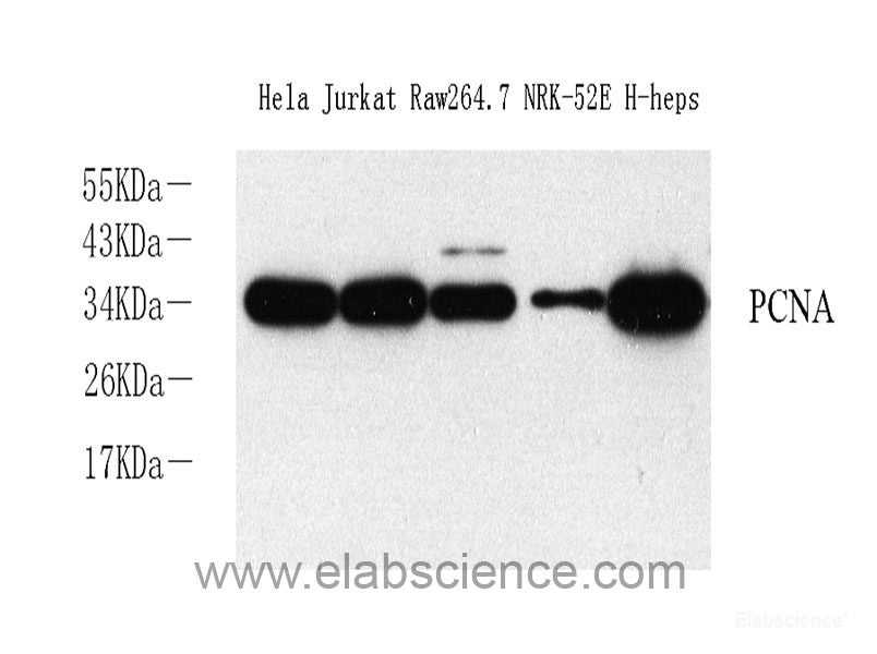 Immunohistochemistry analysis of paraffin-embedded mouse brain using GDNF Polyclonal Antibody at dilution of 1:300.