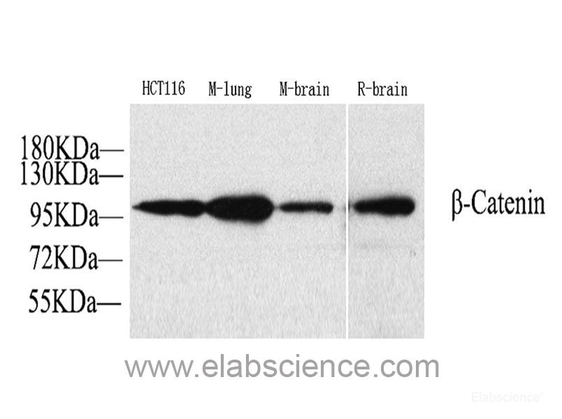 Immunohistochemistry analysis of paraffin-embedded human brain using GLUT-1 Polyclonal Antibody at dilution of 1:300.