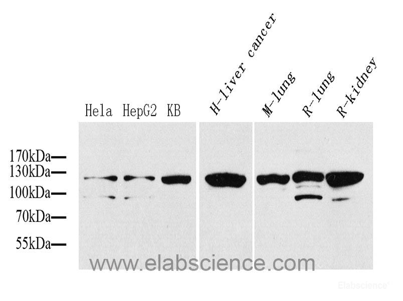 Western Blot analysis of various samples using SIRT3 Polyclonal Antibody at dilution of 1:600.