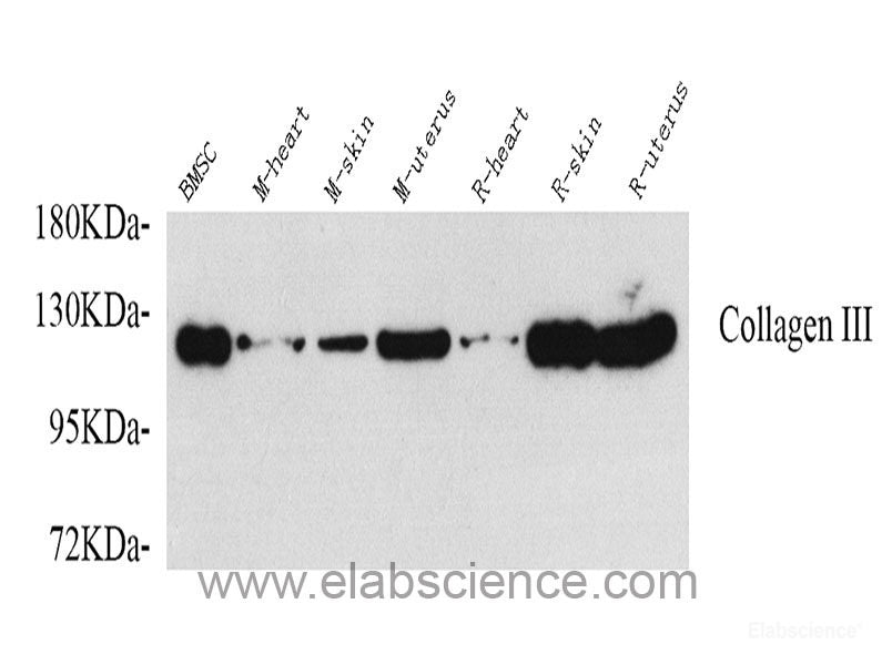 Immunohistochemistry analysis of paraffin-embedded mouse heart using TNNT2 Polyclonal Antibody at dilution of 1:200.