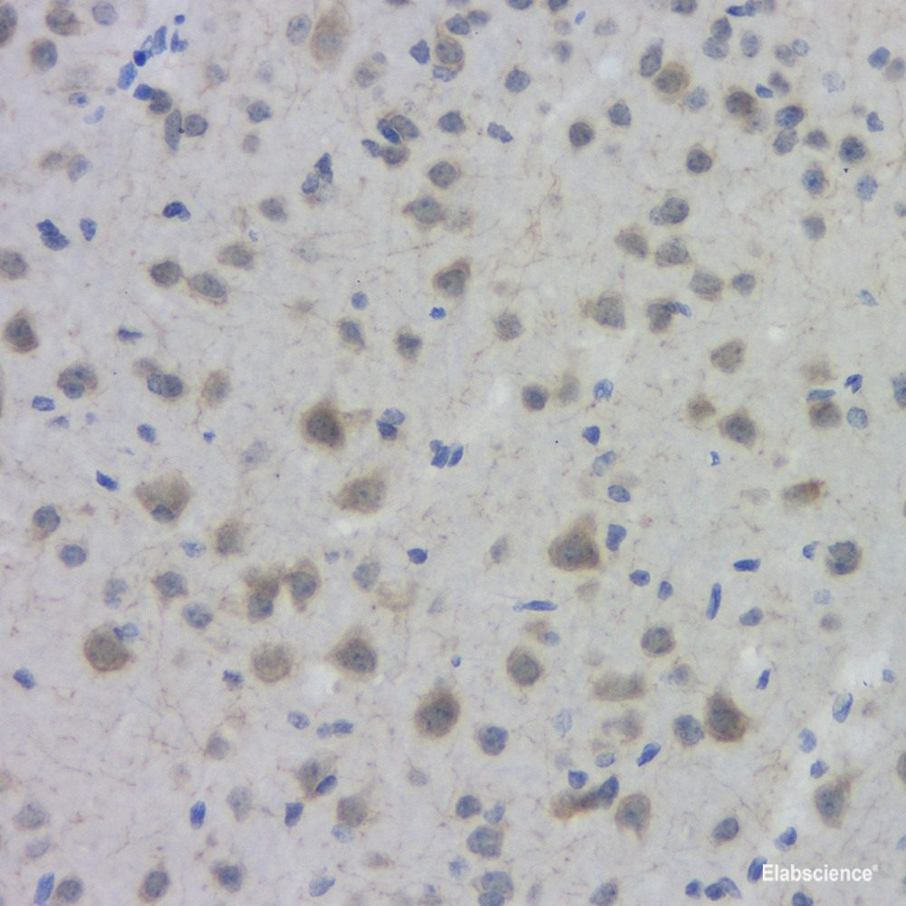 Immunohistochemistry analysis of paraffin-embedded A549 in Human breast using CASP3 Polyclonal Antibody at dilution of 1:400.