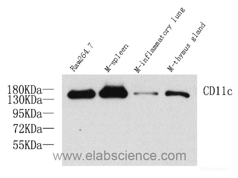 Immunohistochemistry analysis of paraffin-embedded mouse spleen using CD19 Polyclonal Antibody at dilution of 1:200.