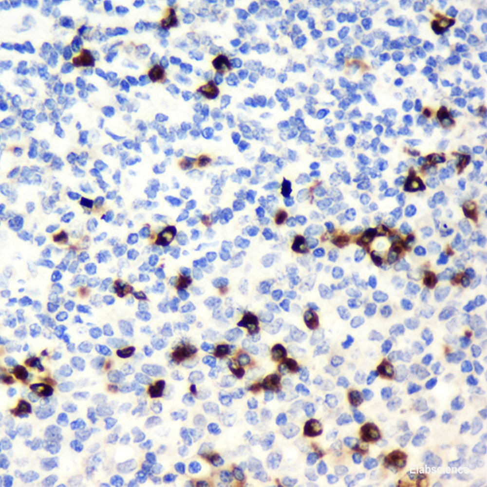 Immunohistochemistry analysis of paraffin-embedded human colon using CCL2 Polyclonal Antibody at dilution of 1:500.
