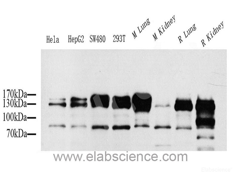 Immunohistochemistry analysis of paraffin-embedded human lung cancer using ATF2 Polyclonal Antibody at dilution of 1:400.