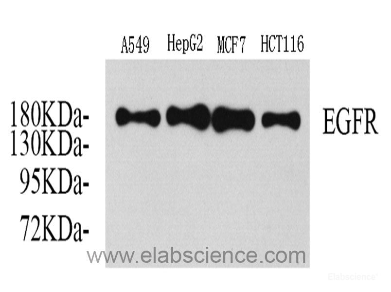 Immunohistochemistry analysis of paraffin-embedded mouse spleen using CD177 Polyclonal Antibody at dilution of 1:300.