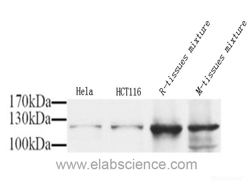 Immunohistochemistry analysis of paraffin-embedded human lung cancer using CD107b Polyclonal Antibody at dilution of 1:300.