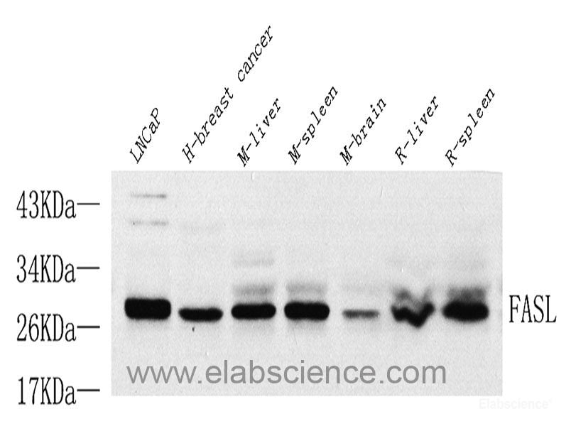 Western Blot analysis of various samples using Survivin Polyclonal Antibody at dilution of 1:600.