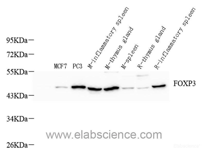 Immunohistochemistry analysis of paraffin-embedded human colon using IL22RA1 Polyclonal Antibody at dilution of 1:200.