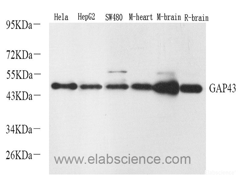Western Blot analysis of various samples using PKM Polyclonal Antibody at dilution of 1:1000.