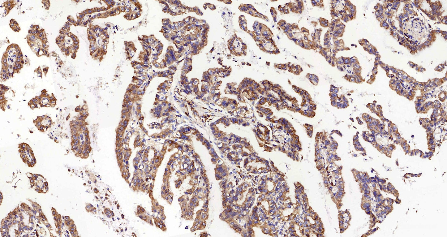 Immunohistochemistry analysis of paraffin-embedded mouse inflammation spleen using INPP5D Polyclonal Antibody at dilution of 1:300.