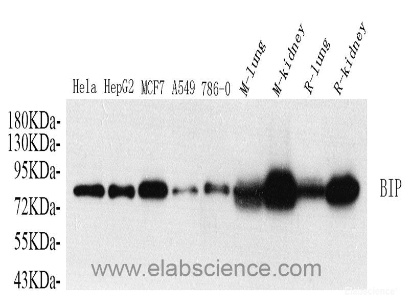 Western Blot analysis of various samples using CK-8 Polyclonal Antibody at dilution of 1:1000.