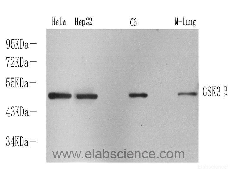 Immunohistochemistry analysis of paraffin-embedded human kidney using CTGF Polyclonal Antibody at dilution of 1:100.