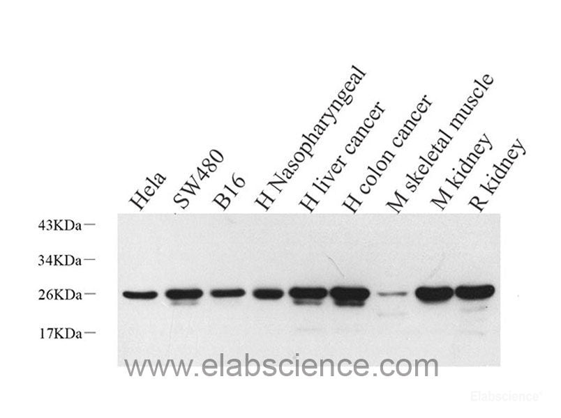 Immunohistochemistry analysis of paraffin-embedded mouse liver using CK-7 Polyclonal Antibody at dilution of 1:300.