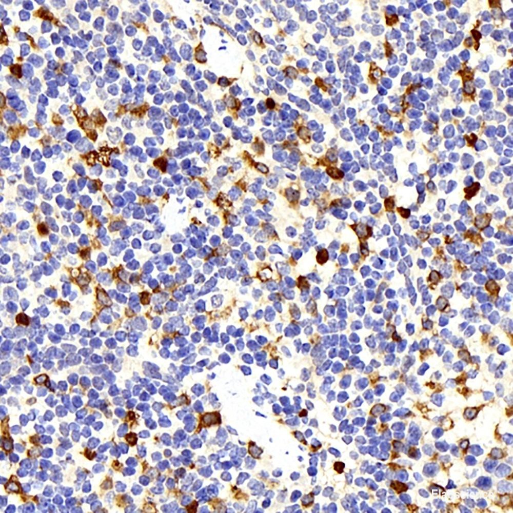 Immunohistochemistry analysis of paraffin-embedded human gallbladder using FAS Monoclonal Antibody at dilution of 1:200.