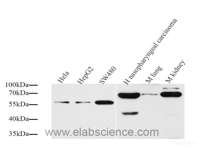 Immunohistochemistry analysis of parafffin-embedded mouse spleen using P2RX3 Polyclonal Antibody at dilution of 1:400.