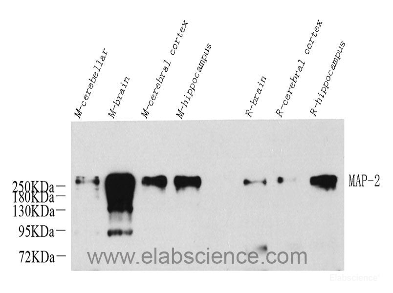 Immunohistochemistry analysis of paraffin-embedded mouse lung using TSC22D3 Polyclonal Antibody at dilution of 1:300.