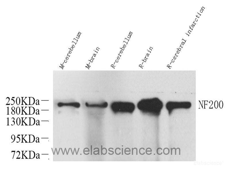 Immunohistochemistry analysis of paraffin-embedded human tonsil using c-Kit Polyclonal Antibody at dilution of 1:200.