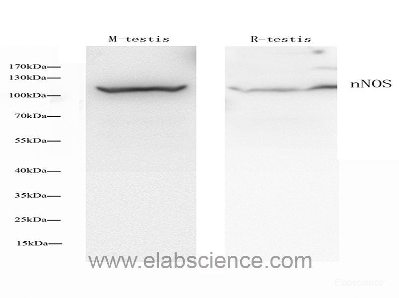 Western Blot analysis of various samples using ARG1 Polyclonal Antibody at dilution of 1:1000.